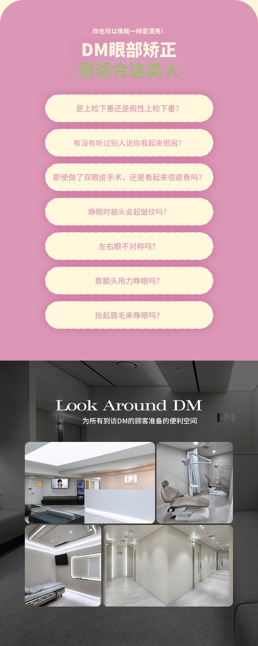 ♥DM眼形矫正♥