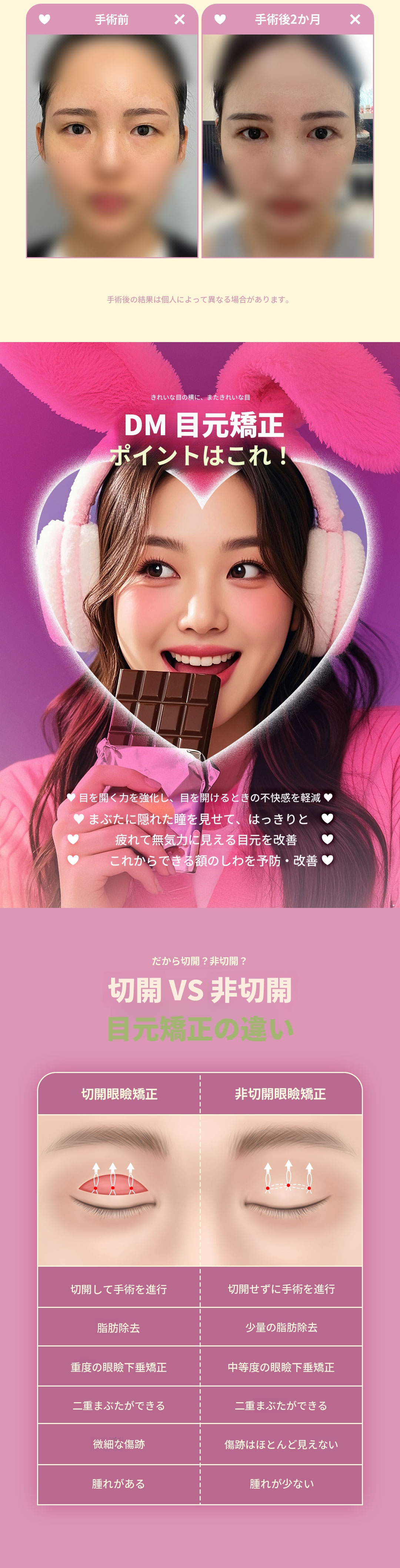 ♥DM目の形矯正♥