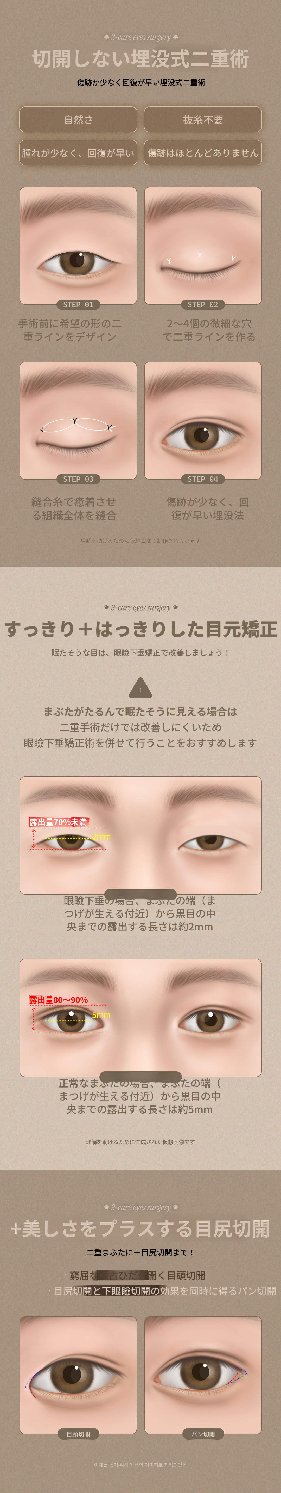DMスリーケア目の形成手術