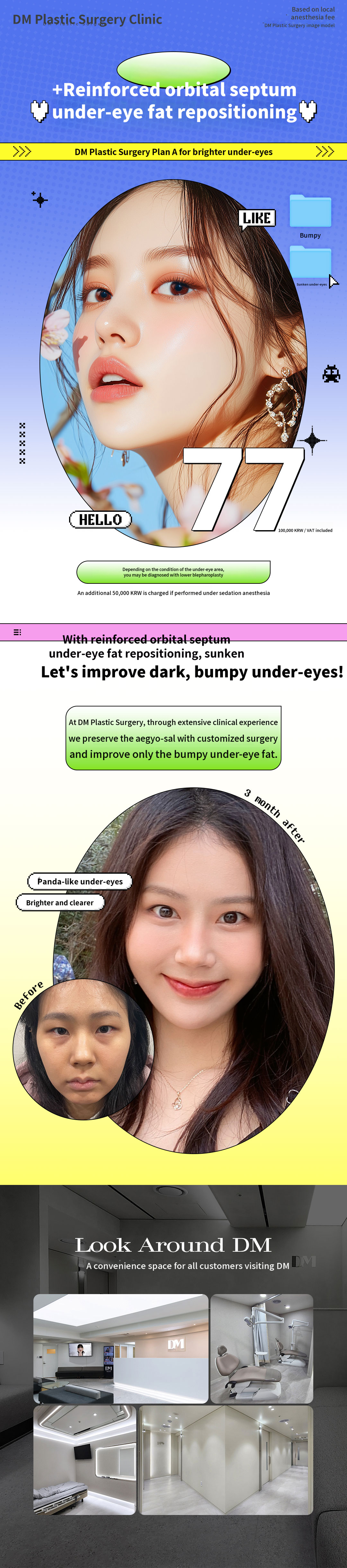 Lower Eyelid Fat Repositioning with Membrane Reinforcement