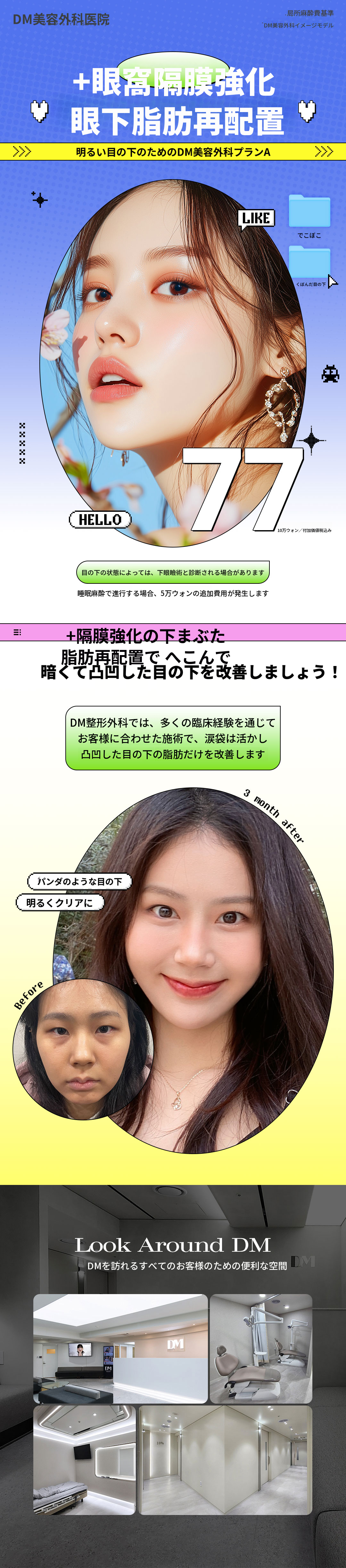 メッセンジャーによる眼下脂肪の再配置