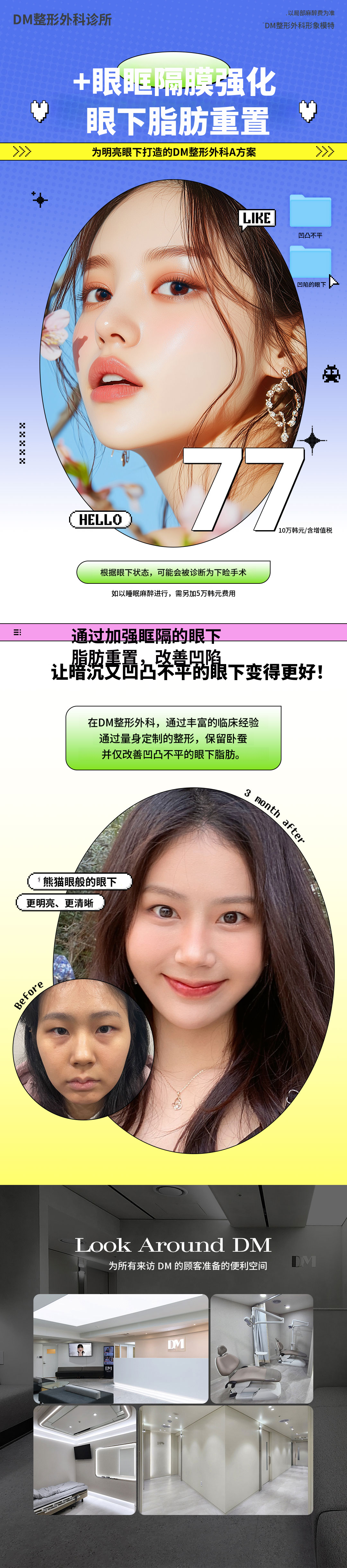眼袋下脂肪重塑