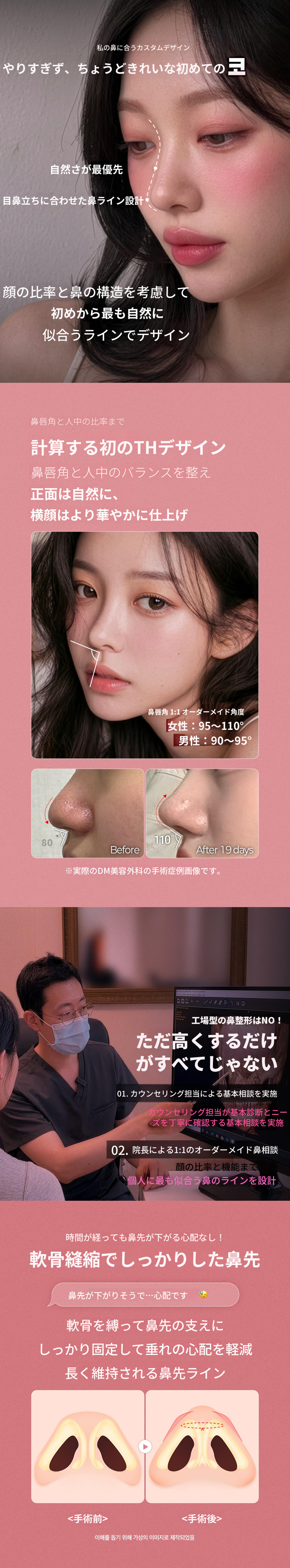 ♥DM初鼻整形♥