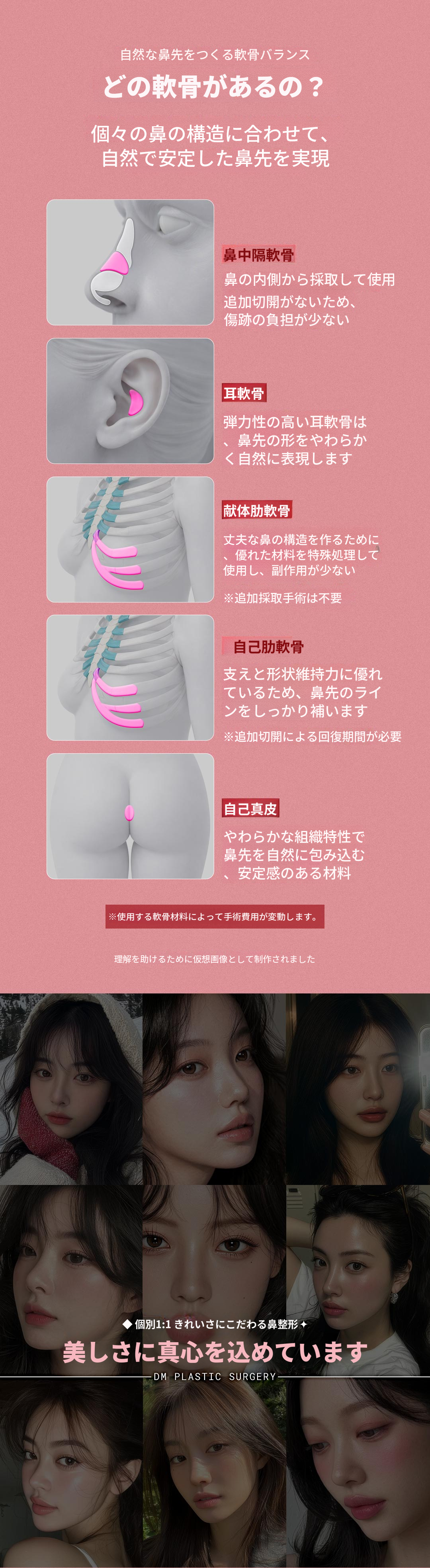 ♥DM初鼻整形♥