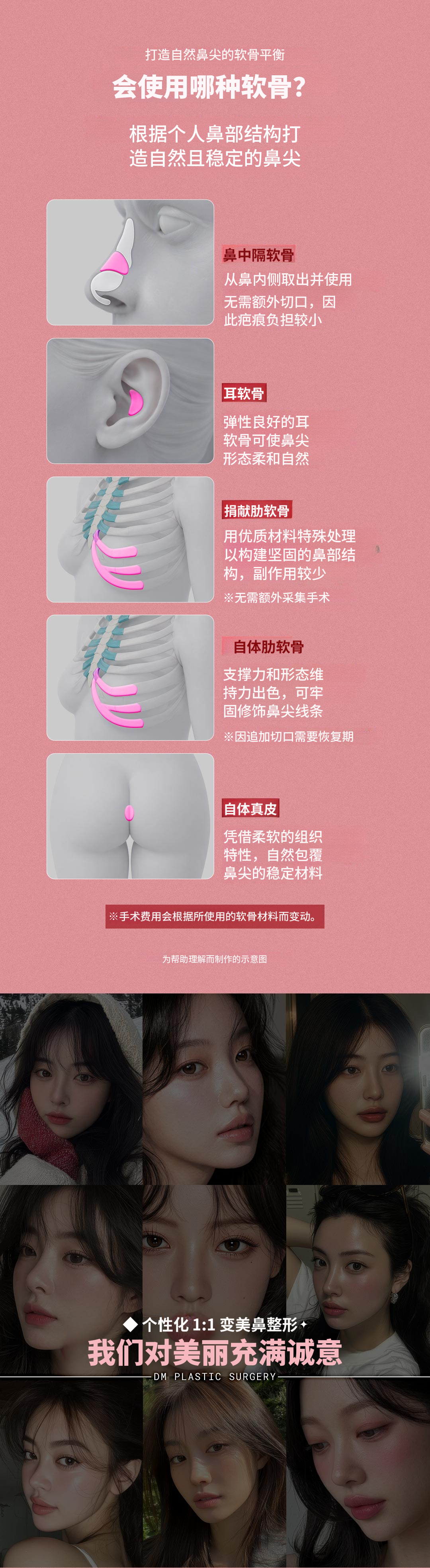 ♥DM首次隆鼻♥