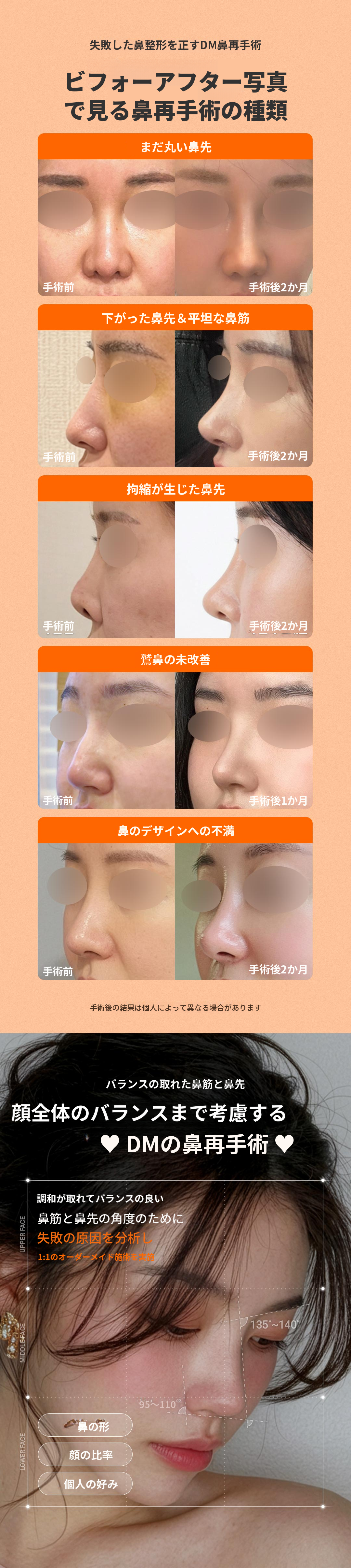 ❤ DM 鼻の再手術 ❤