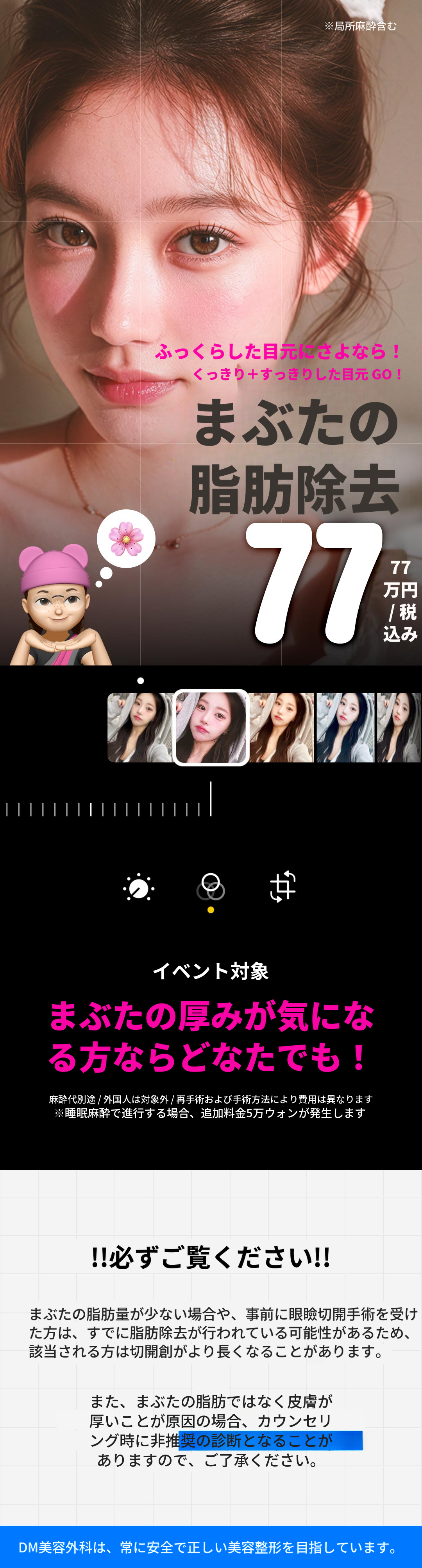 DMまぶたの脂肪除去