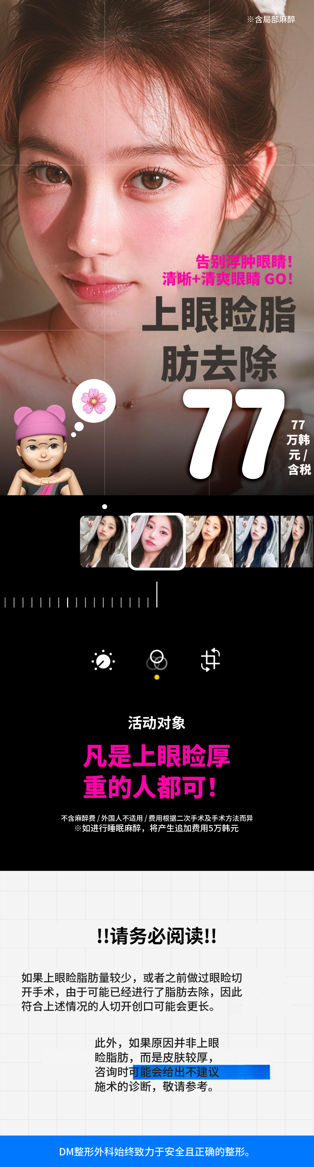 DM眼睑脂肪去除