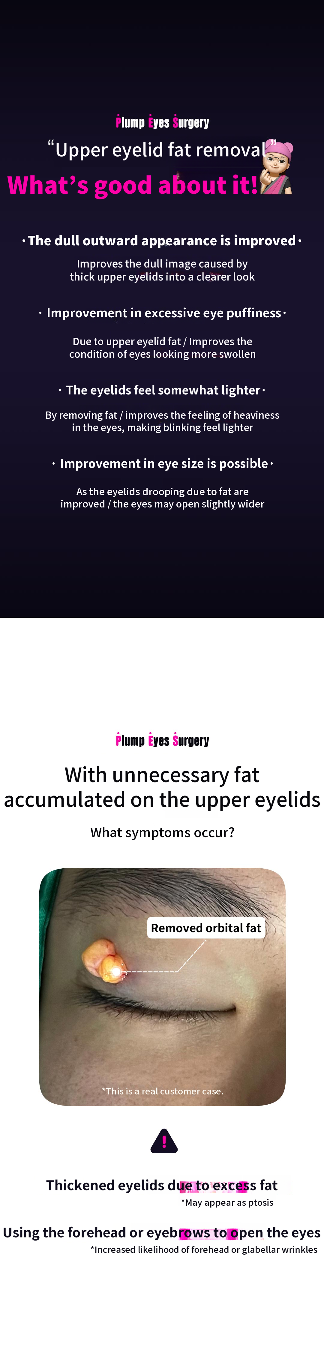 DM Eyelid Fat Removal