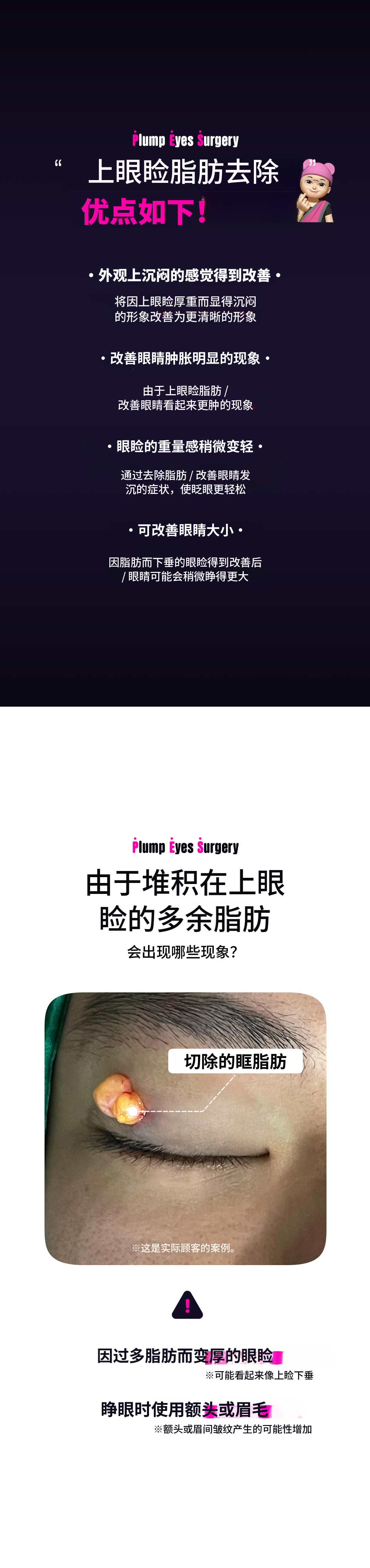 DM眼睑脂肪去除