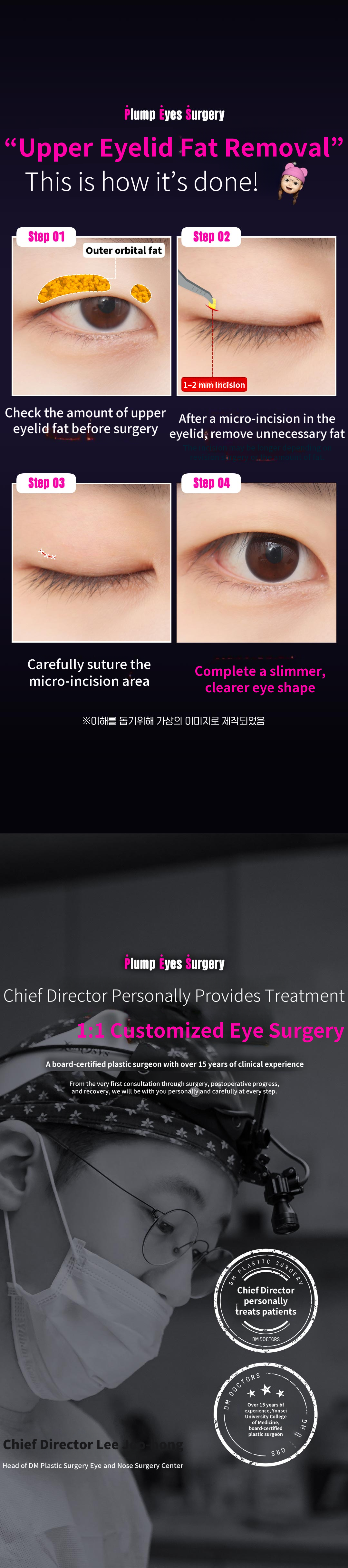 DM Eyelid Fat Removal