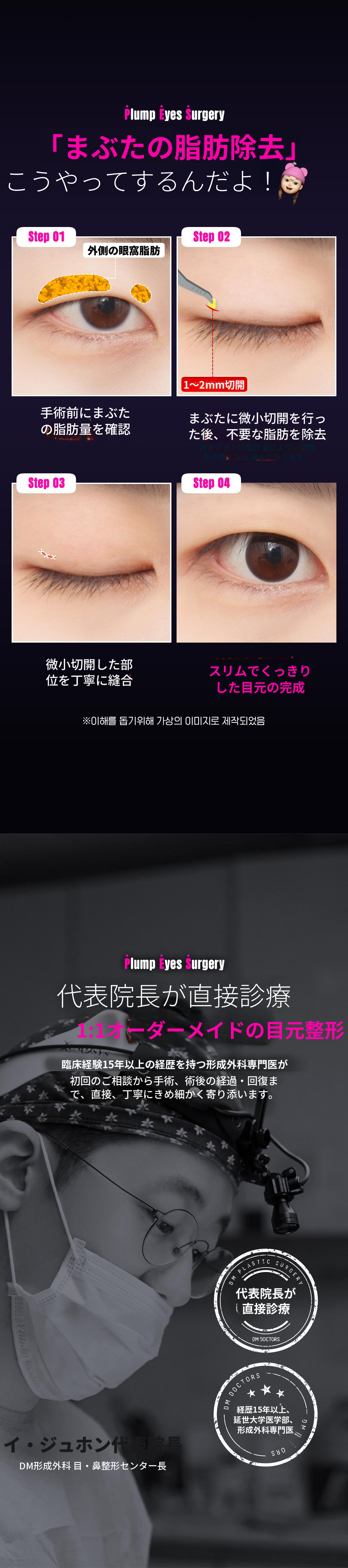 DMまぶたの脂肪除去