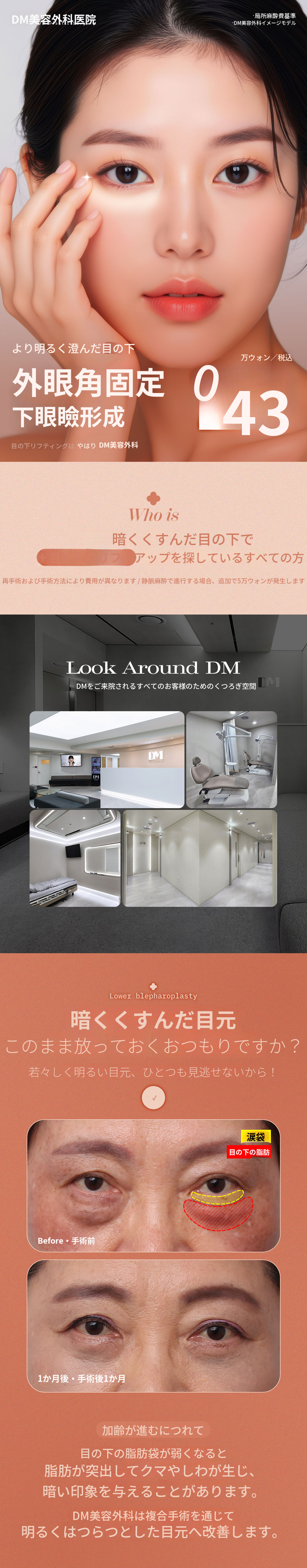 ♥DM外眼角固定下まぶた手術♥
