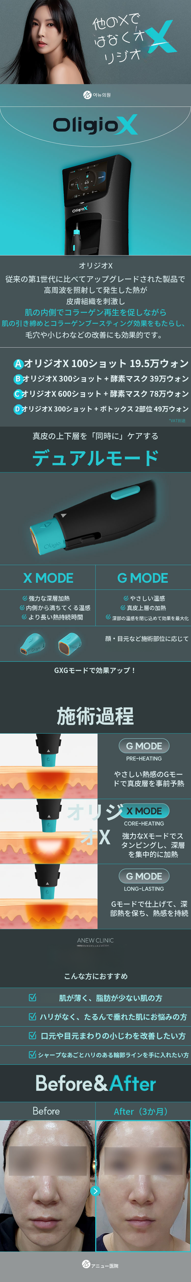 デュアルモード、オリジオX