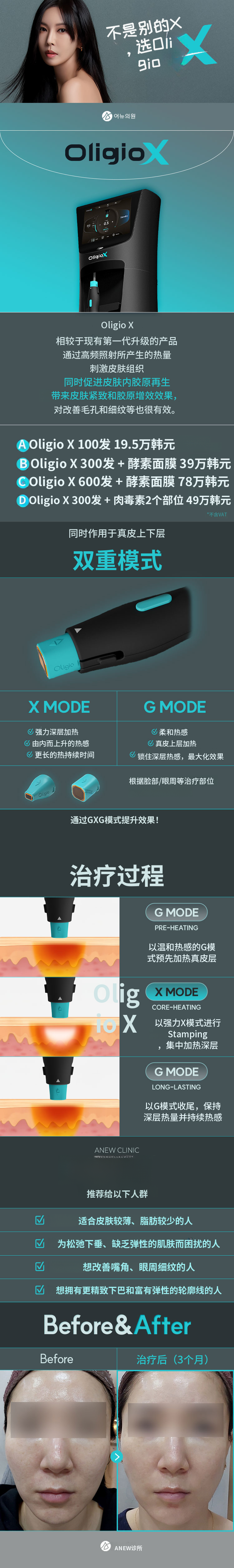 双模，全新升级X