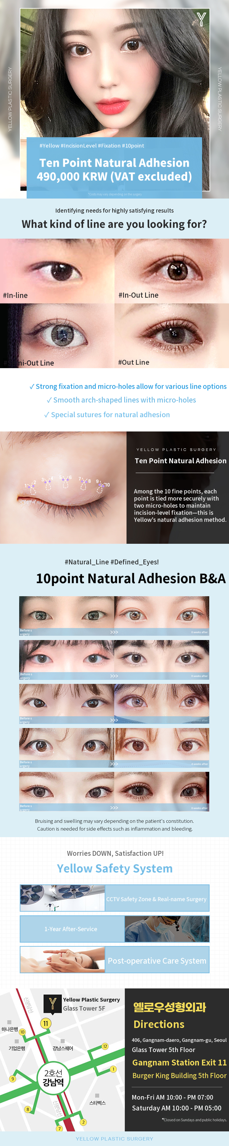 💛Yellow ten-point natural adhesion💛