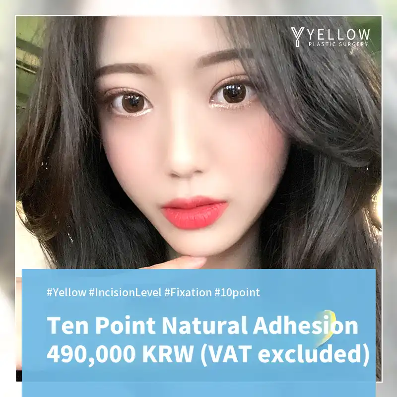 💛Yellow ten-point natural adhesion💛