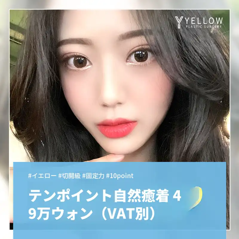 💛イエロー10ポイント自然接着💛