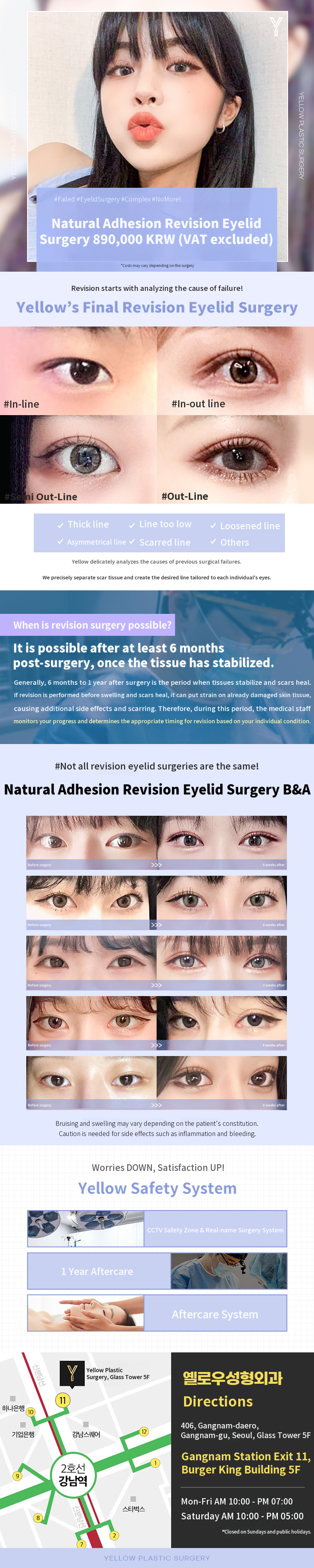 💛Yellow nose revision💛