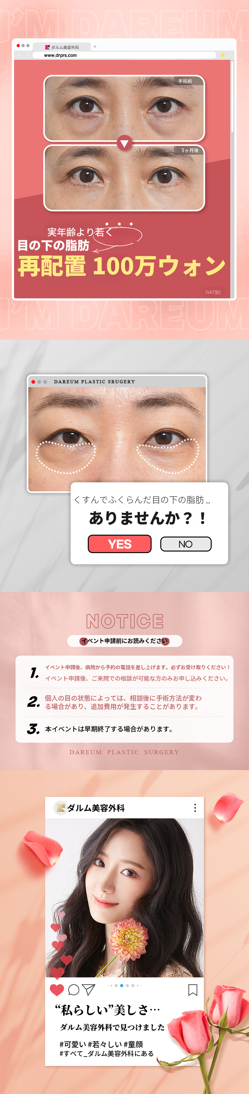 暗い目の下?別の目の下脂肪再配置