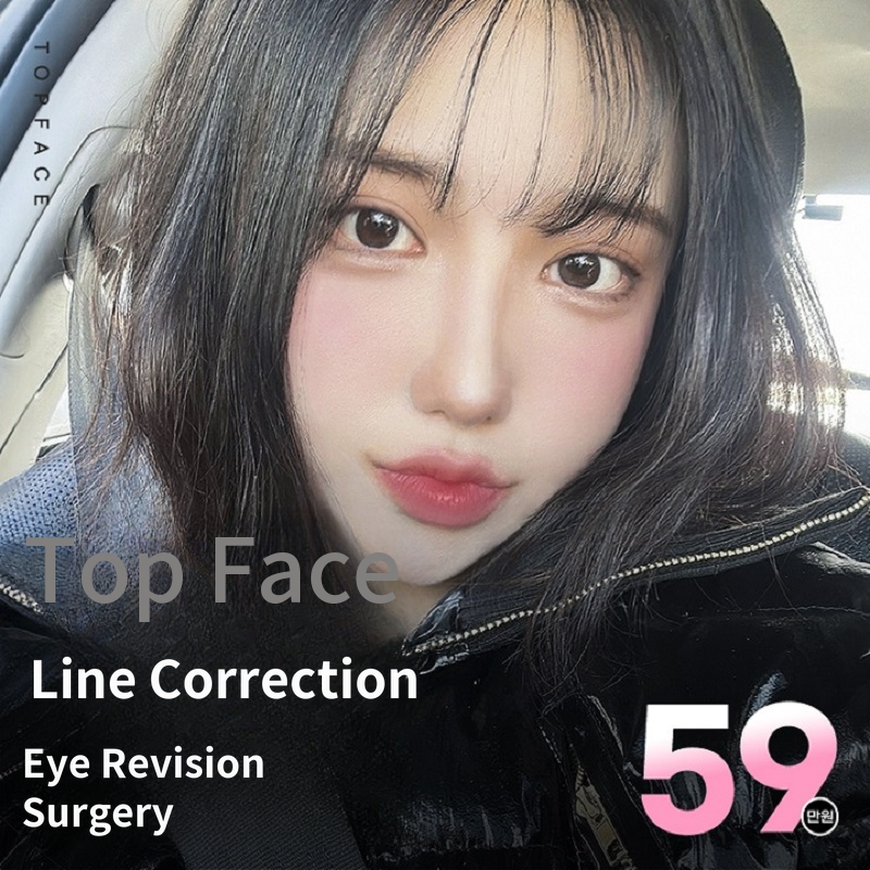 Top face➰#Nose revision