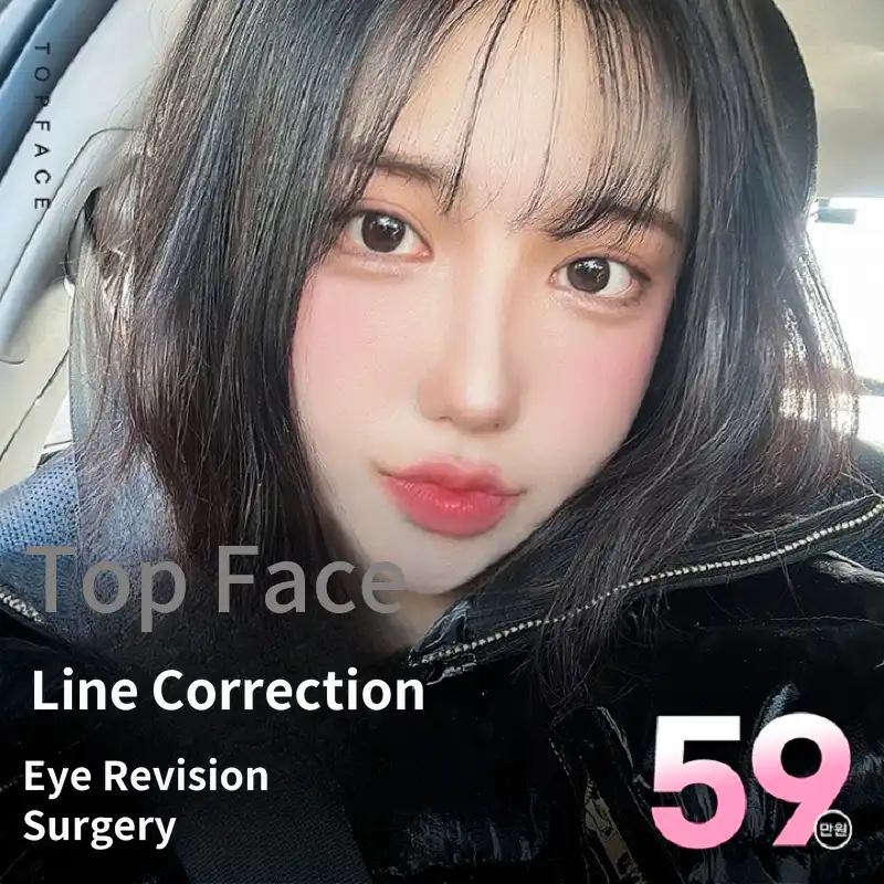 Top face➰#Nose revision