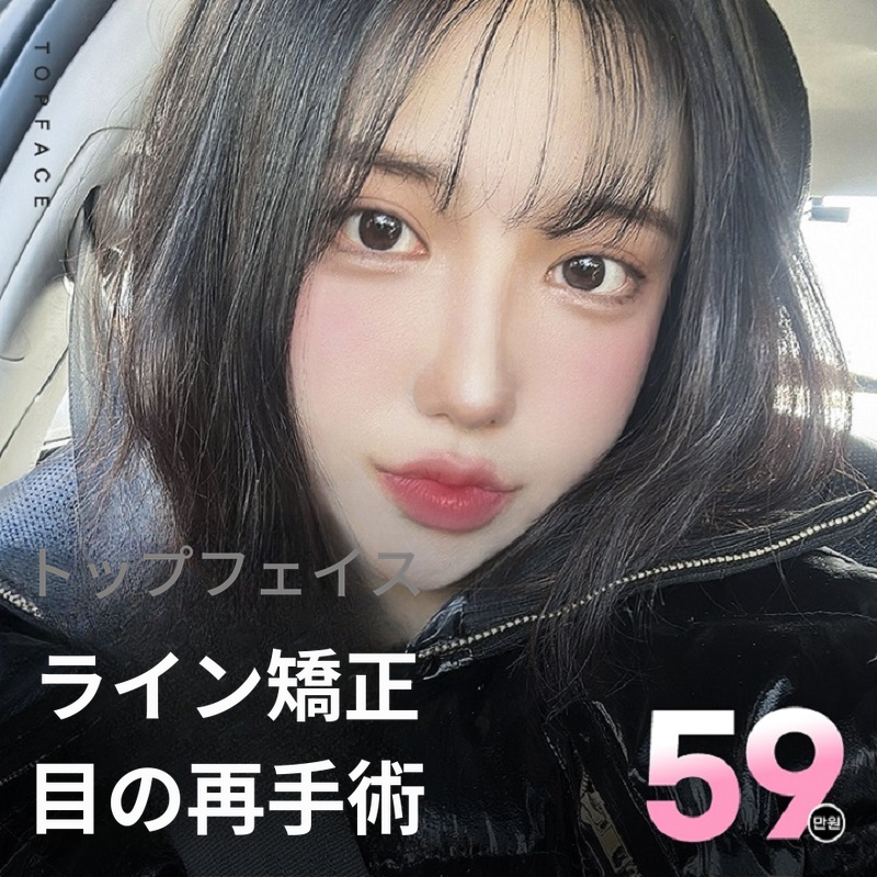 トップフェイス➰#目再手術