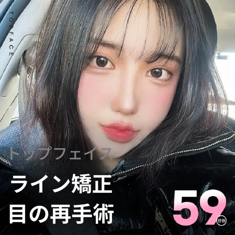 トップフェイス➰#目再手術