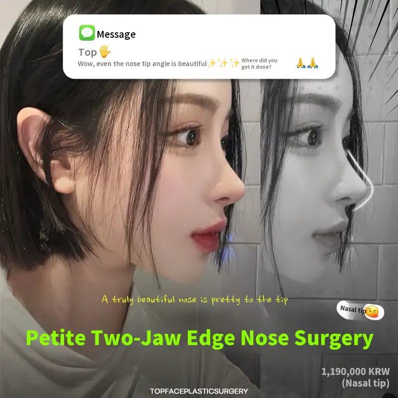 #Top face💖Edge nose surgery