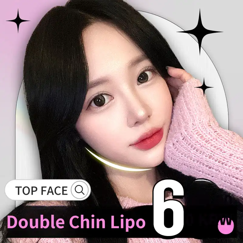 #Double chin liposuction💕V-line