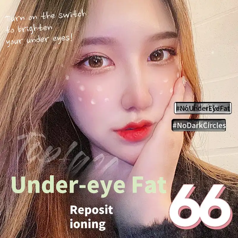 💖Under-eye fat repositioning💖