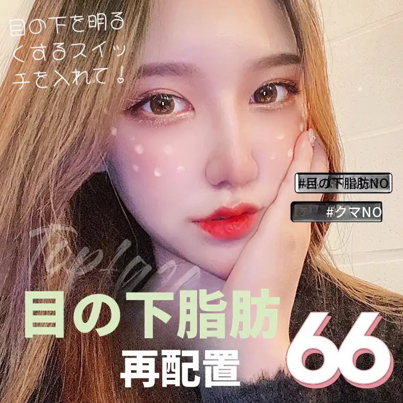 💖目の下脂肪再配置💖