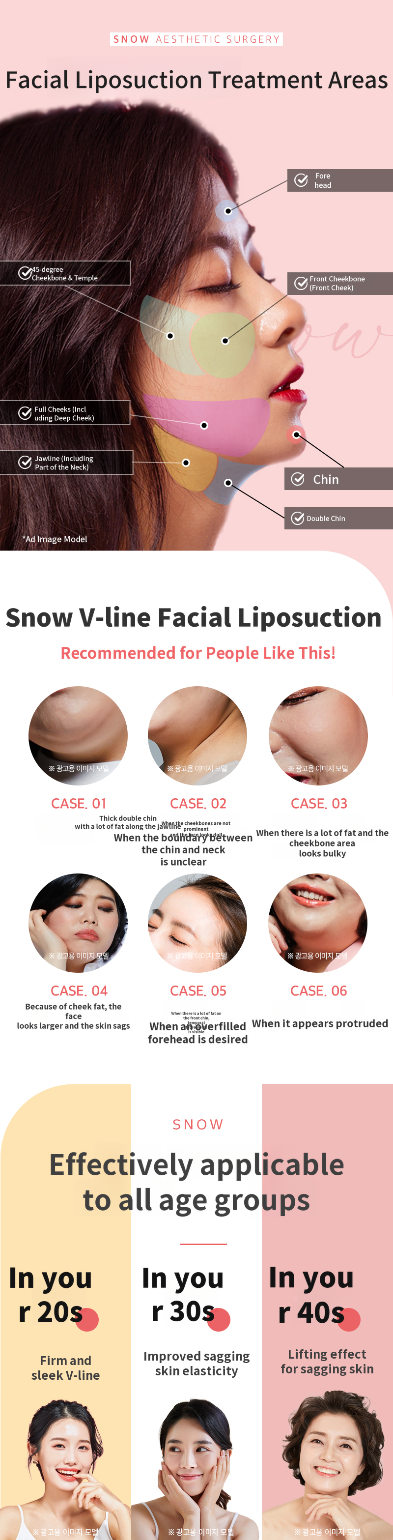 Large Volume Facial Liposuction