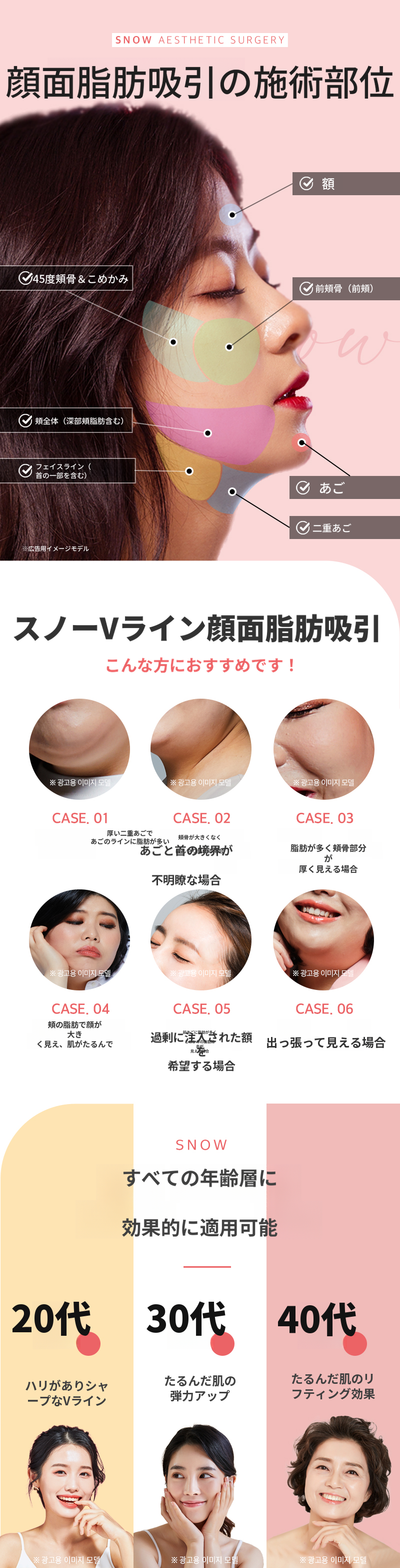 大容量顔脂肪吸引