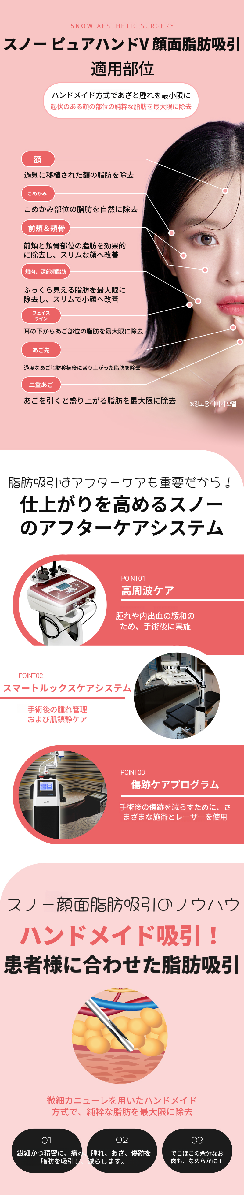 大容量顔脂肪吸引