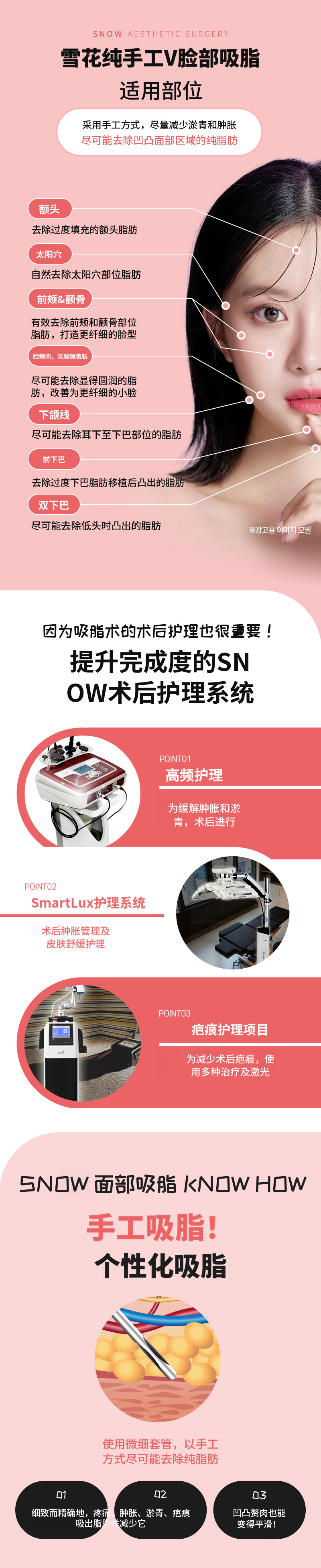 大容量面部脂肪抽吸