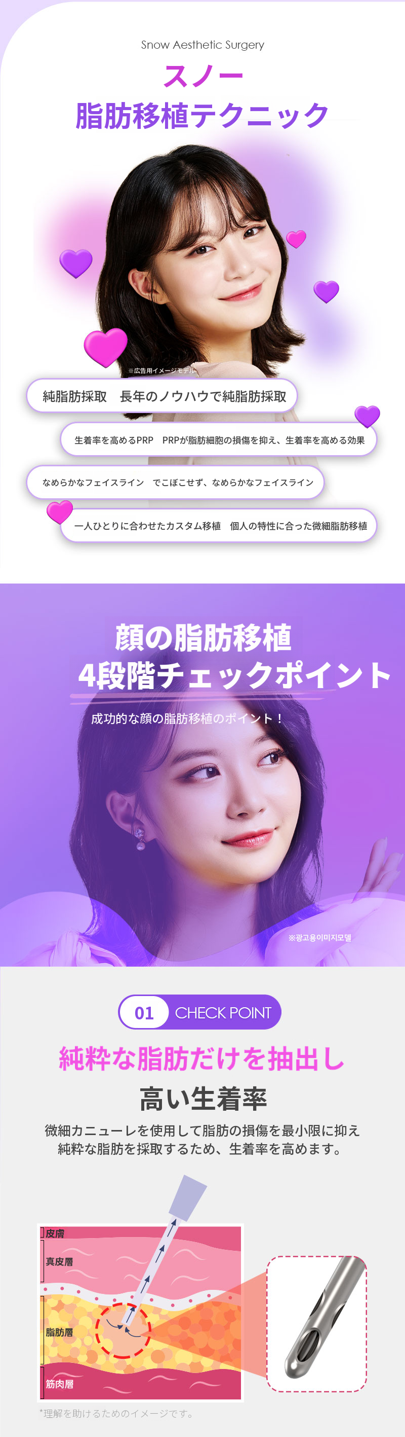 PRP顔面脂肪移植