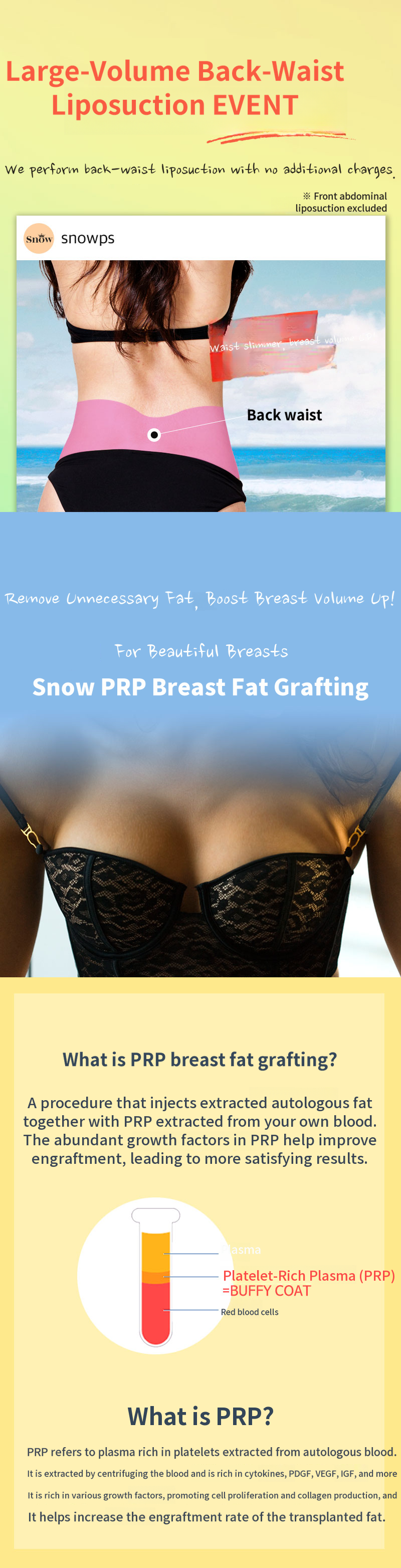 PRP Breast Fat Grafting