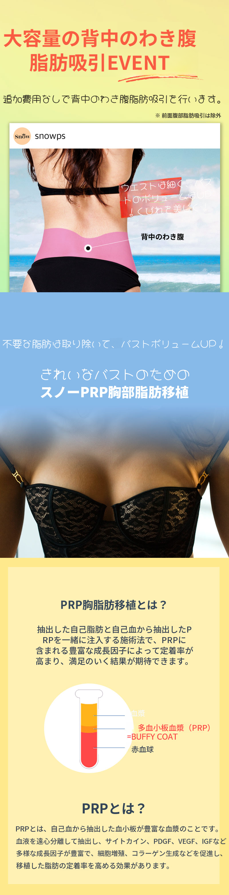 PRP胸部脂肪移植