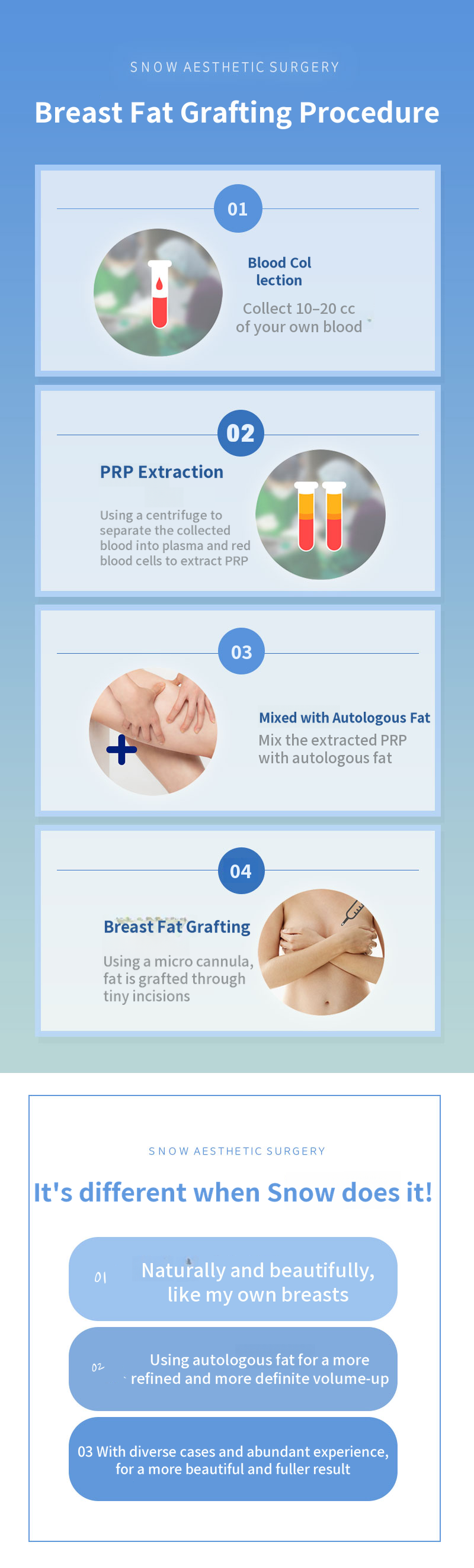 PRP Breast Fat Grafting
