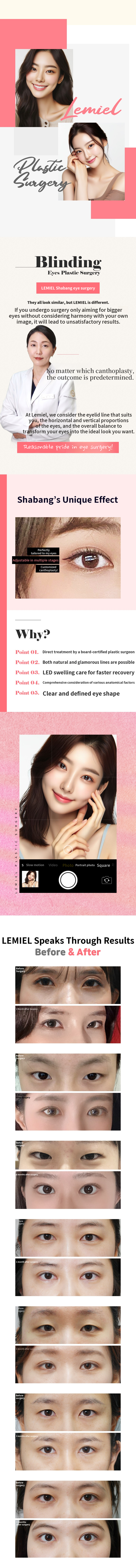 Lateral canthoplasty, upper canthoplasty, lower canthoplasty - 18 years of experience as a board-certified plastic surgeon