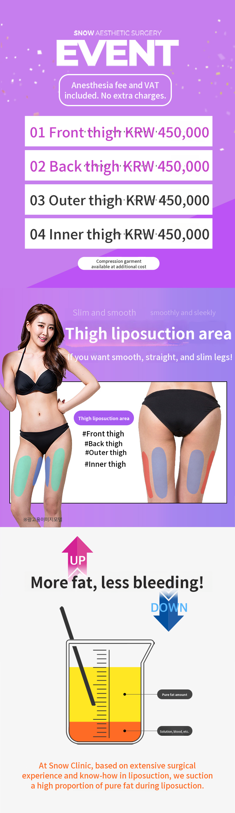 Large Volume Thigh Liposuction