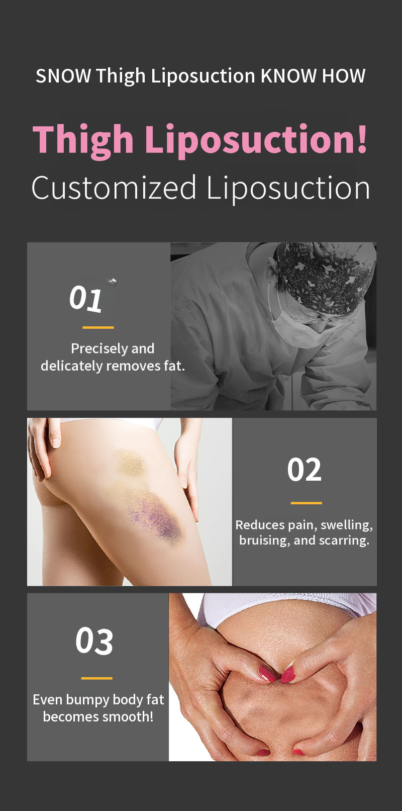 Large Volume Thigh Liposuction