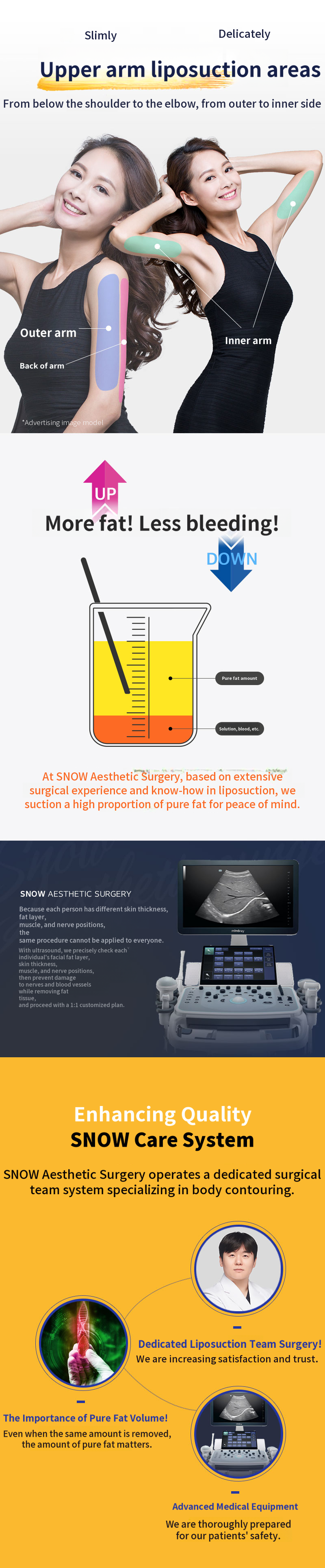 Large Volume Arm Liposuction