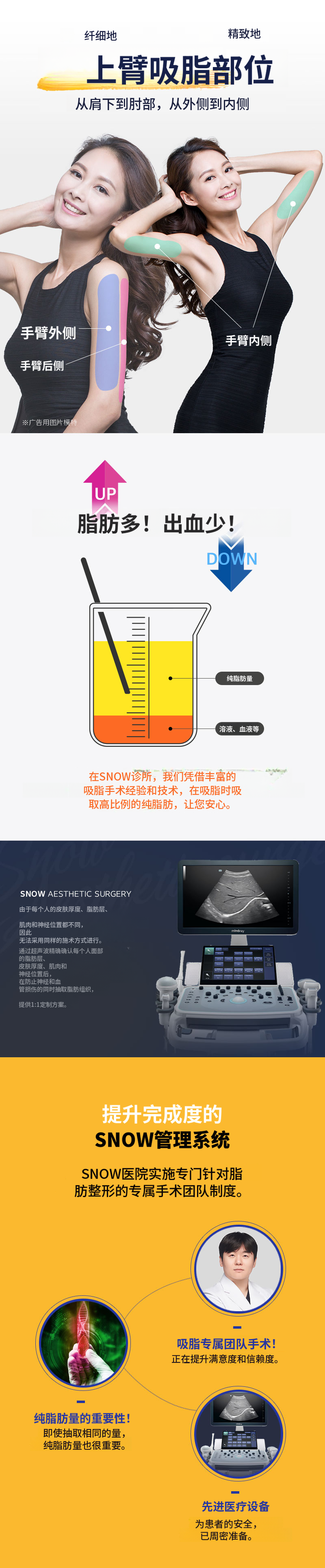 大容量手臂抽脂