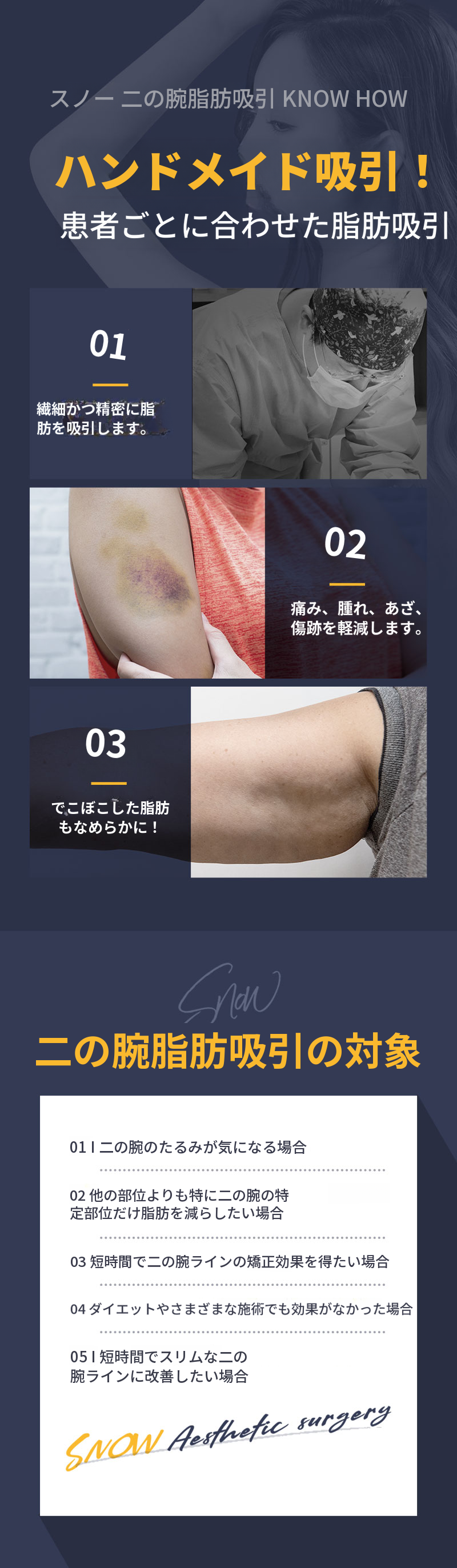 大容量腕部脂肪吸引