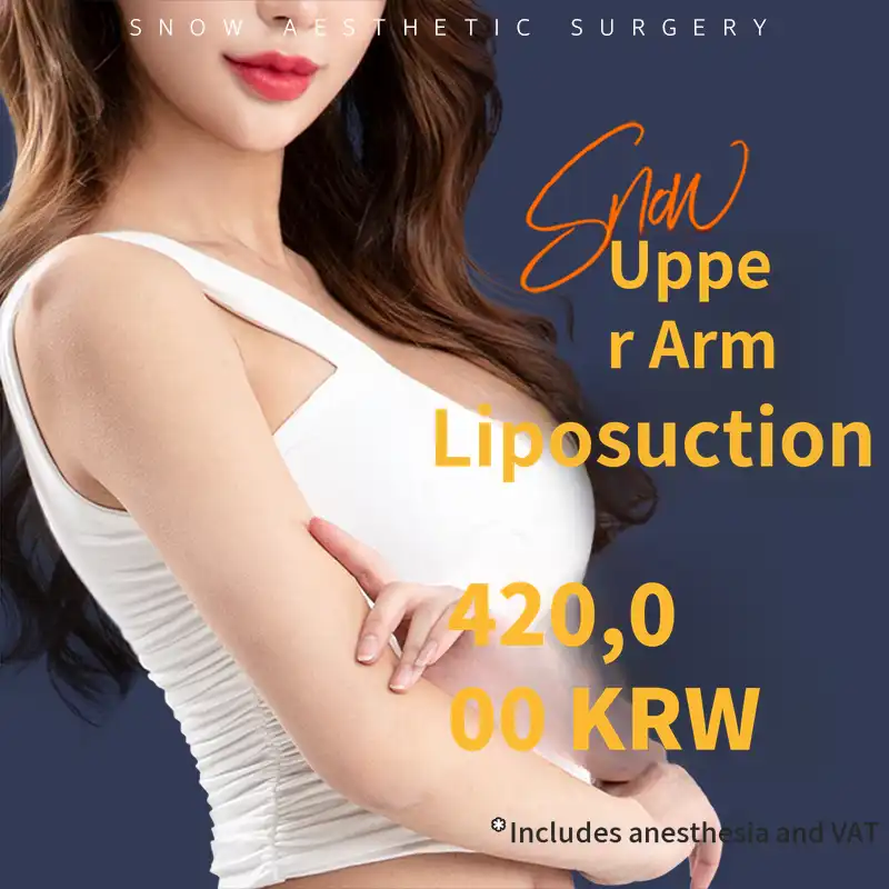Large Volume Arm Liposuction