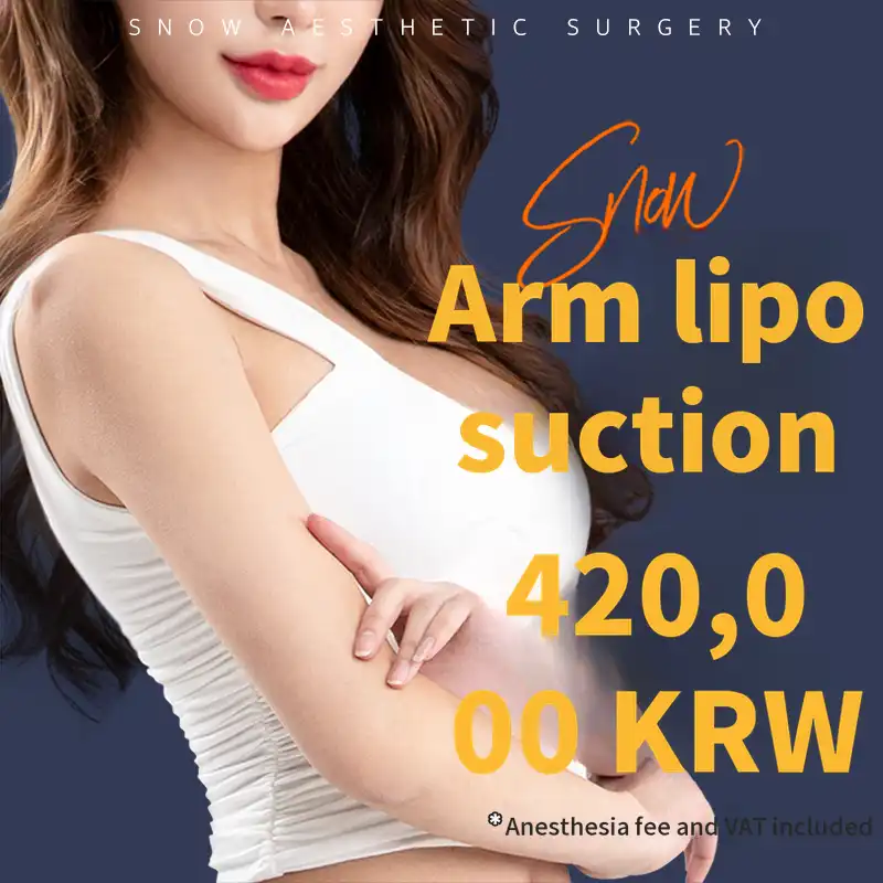 Large Volume Arm Liposuction