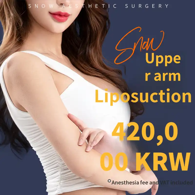 Large Volume Arm Liposuction