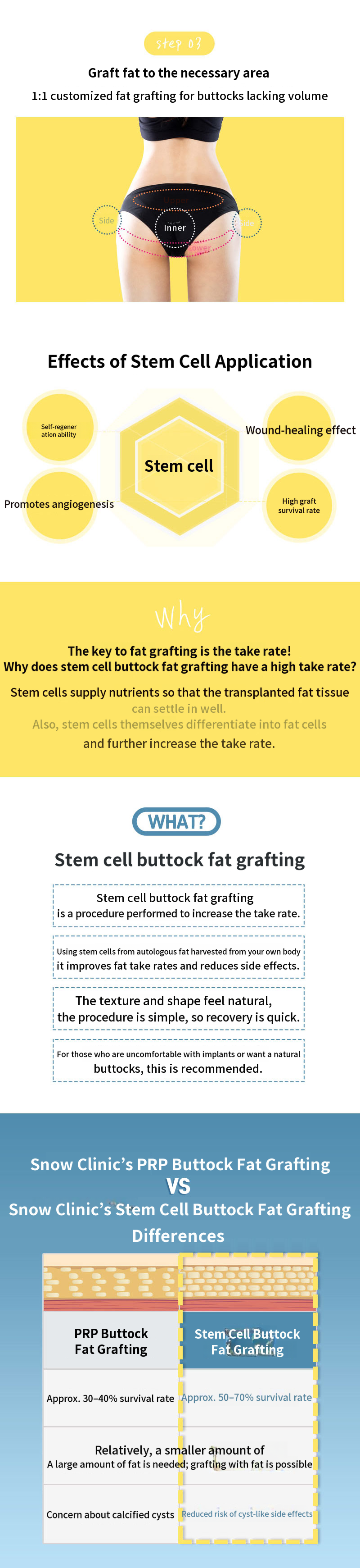 Stem Cell Butt Lift Fat Grafting